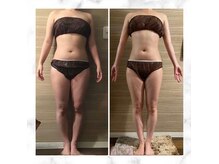 エムズ ビューティー サロン(M's Beauty Salon)の雰囲気（痩身/ダイエット/表参道/青山/渋谷/美脚/くびれ/下半身/セル脂肪）