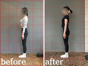 ヴレ 福岡店(Vraie)/肋骨の開きや反り腰改善も得意!