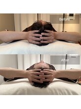 小顔矯正&美容整体サロン　Still U 渋谷/贅沢フルコース♪