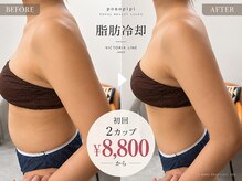 ポノピピ 小倉本店(ponopipi)の雰囲気（結果重視！今スーパー話題最新脂肪冷却マシーン）