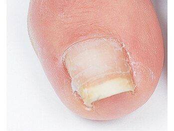 アイリーネイル(IRIE NAIL)/B/Sクイック