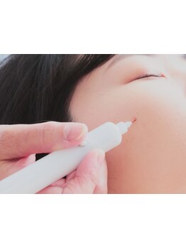 シミしわ改善！予防ケア