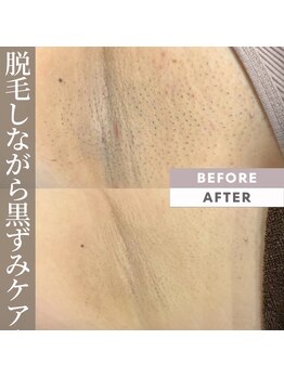 モア トゥインクル 緑井店(MORE twinkle)/