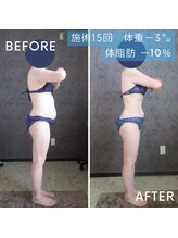 ヴィオテラス(VIOTERACE)/３ヶ月集中ダイエット☆