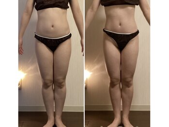 サロン アンネ(Anne)/ウィンバック痩身