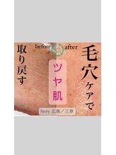 レンリー(Renry)/鼻だけじゃない！