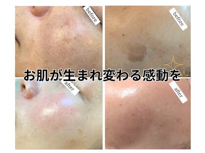 イロドリ(irodori)の写真
