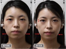 さつま骨格矯正 表参道青山院/歪み小顔矯正＋骨盤矯正