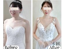 蒼(so)の雰囲気（ブライダルエステ整体。広い肩幅/顔の輪郭/頬骨/猫背/巻き肩etc）