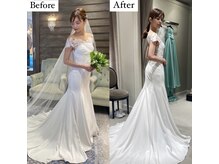 コルミチョン サロン(骨美整 salon)/ブライダル施術　Before・After