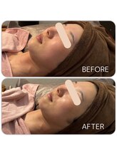 マーレ(Mare)/ララピール &nbsp;ツヤ肌×透明感