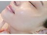 2回目以降はこちら【毛穴でお悩みの方へ】大人気のララピールで韓国肌管理