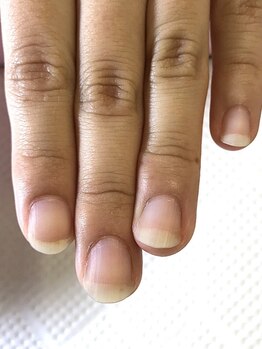 爪の悩みを解消できる（ケア含む）