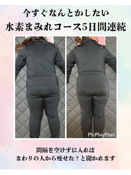 ヨサパーク クラミツハ(YOSA PARK)/痩身