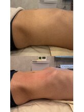 ブリア 横浜(BRILLA)/腸もみ１回での効果