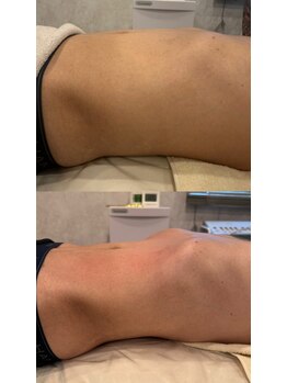 ブリア 横浜(BRILLA)/腸もみ１回での効果