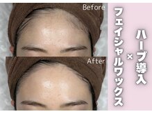 お顔のワックス+ハーブ導入で即効ツヤ肌に♪