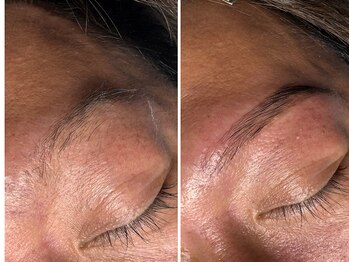 凛眉(LINVI)/眉を整えるだけでここまで変わる