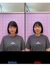 カルミア鍼灸接骨院/美容鍼ビフォーアフター