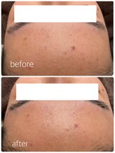 カイト(Kaito)/ハーブリプロ