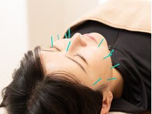 楓 桜木町/美容鍼も◎