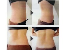 エルム/塗る脂肪燃焼クリーム♪