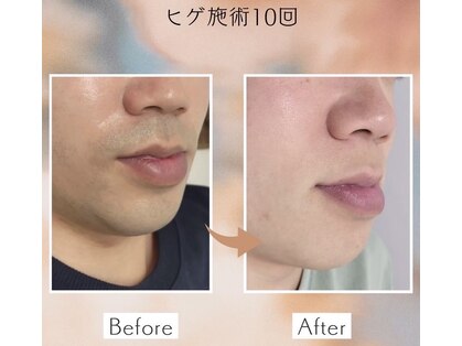 ソライロの写真