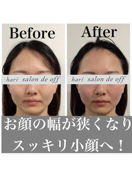 ハリサロンドオフ 心斎橋店(hari salon de off)/小顔への道