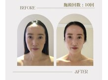ビーキュート 渋谷北参道店(BE-CUTE)/お客様ビフォーアフター　4０代