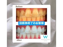 ホワイトニングショップ 会津若松店