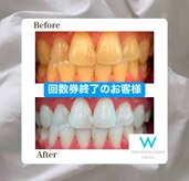 ホワイトニングショップ 会津若松店