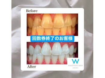 ホワイトニングショップ 会津若松店