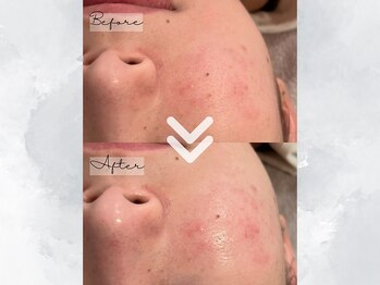 サイバーエステ 宇都宮店/美肌・美白へ近づく肌メンテ