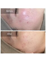 素肌研究所BSラボ/