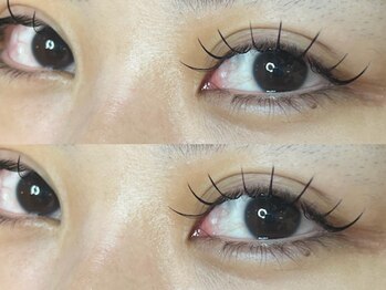 ナナリスボン 福岡(NANA LISBON)/フラット120本