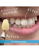 ホワイトニングカフェ 葛西店(WhiteningCafe)/ホワイトニング葛西