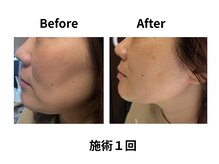 ティアレソワン(tiare soin)の雰囲気（業界25年以上の経験◎延べ16500回施術歴あり）