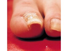 アイリーネイル(IRIE NAIL)/B/Sクイック