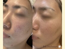 バリマ ビューティー(Bali Ma'beauty)/お肌の基礎作りからしっかりケア