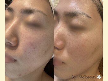 バリマ ビューティー(Bali Ma'beauty)/お肌の基礎作りからしっかりケア