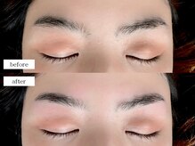 エムドット(m.)/アイブロウワックス脱毛