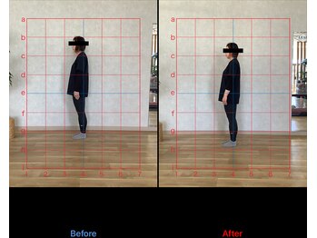 リード整骨院(LEAD整骨院)/ピラティスで猫背改善#肩こり