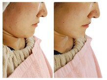 ベリッセ(Belisse)/レモンボトル＊フェイスライン