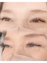 ミンピ(Mimpi)/アンドヘルシー×BINDROCK