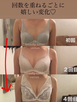 ヴィーナス(Venus)/バストの位置で小顔効果