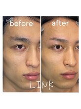 リンク(LINK)/癖毛でお悩みの方