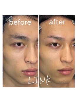 リンク(LINK)/癖毛でお悩みの方