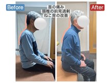 アンティオール 札幌店/70代男性　ねこ背の改善