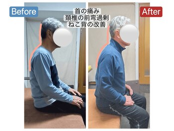 アンティオール 札幌店/70代男性　ねこ背の改善