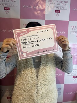 エクシアホワイトニング 前橋店/お客様の声